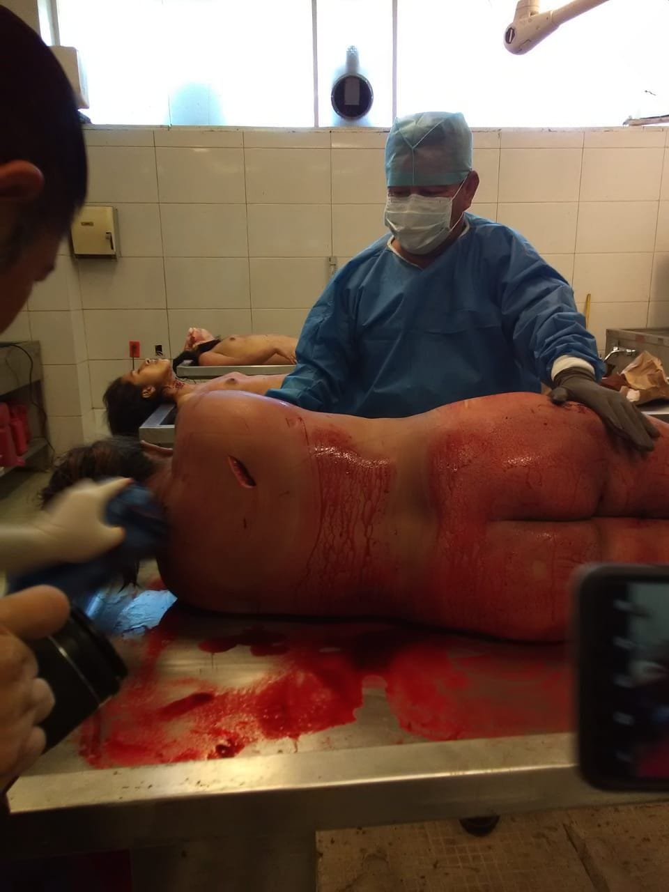 全裸 解剖 超！閲覧注意】3人の全裸女性が並べられた。これから何が始まるか（画像あり） - ポッカキット