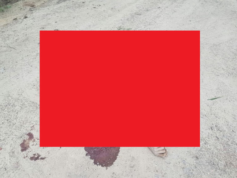 【閲覧注意】象に踏み潰された人間・・・・・（画像あり）