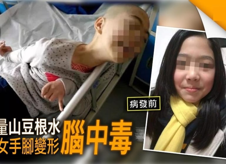 【閲覧注意】11歳の少女、「このお茶」を飲み痙攣、手足が変形、言語・行動が乳幼児ほどに退化する