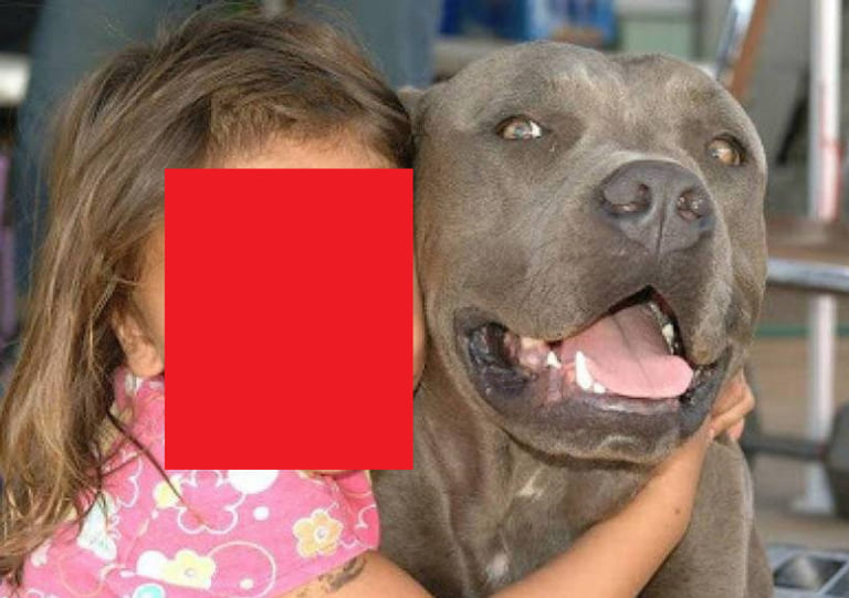 【閲覧注意】”世界で最も狂暴な犬” と幼女 ⇒ その後こうなりました…（画像あり）