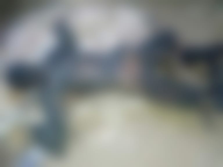 【閲覧注意】喧嘩で負けた大学生の体が超ヤバイと話題に・・・（画像あり）