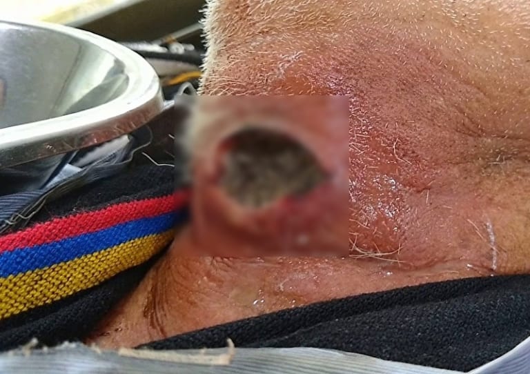 【閲覧注意】のどに ”数千匹の生物” が暮らしている人間、激写される