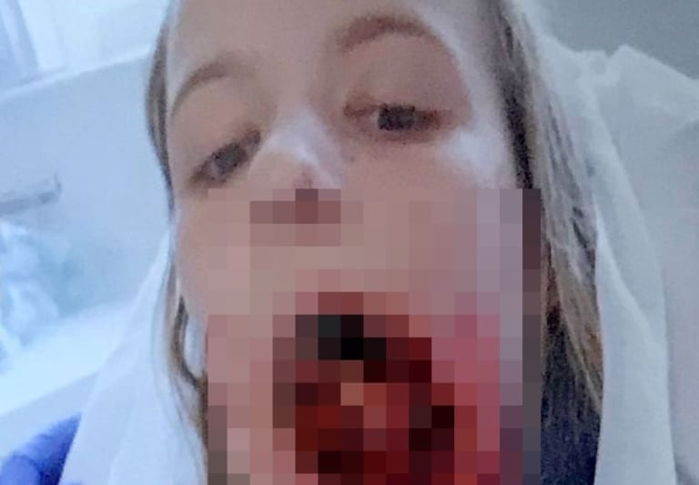 【閲覧注意】美人女子高生、馬に顔面崩壊させられる