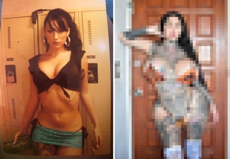 【閲覧注意】整形モンスターの元美女、マ●コを世界一大きくしようとして死にかける（画像あり）