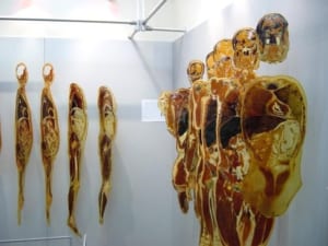 【閲覧注意】人間には1か所だけ、完全に切断されても再生できる箇所がある。ココだ