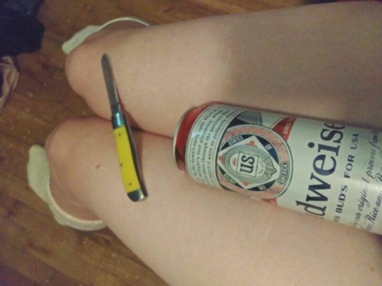 【閲覧注意】グロサイトやってるんだが、10代の女の子が恐ろしい画像投稿してきた