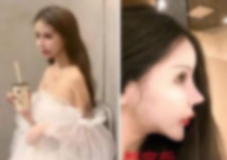 【閲覧注意】女子高生が100回の美容整形を受けた結果…（画像あり）