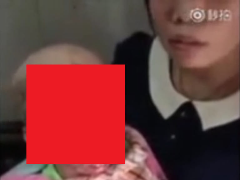 【閲覧注意】TVでインタビューされた障害者の娘を育てる母親 ⇒ 娘の姿がさすがにヤバいと話題に