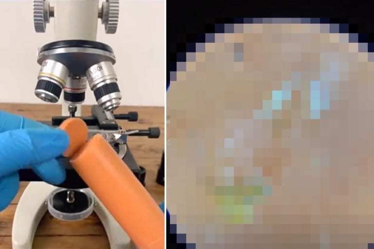 【閲覧注意】ソーセージを顕微鏡で見たら二度と食べられなくなる理由