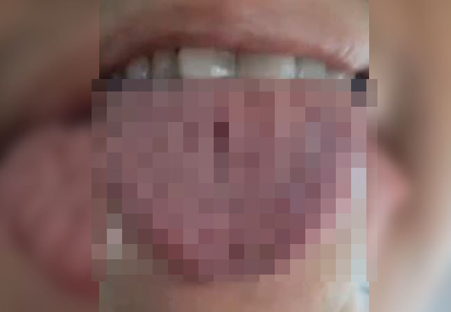 【閲覧注意】これ、気持ち悪くない人いるの…？（動画あり）