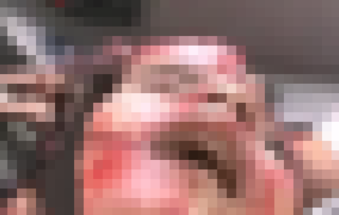 【超！閲覧注意】脳が完全になくなった女の子、なぜか喋り出してしまう…（動画あり）