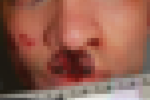 【閲覧注意】電子タバコ使ってた男性が死亡。その死に方が怖すぎると話題に（画像）