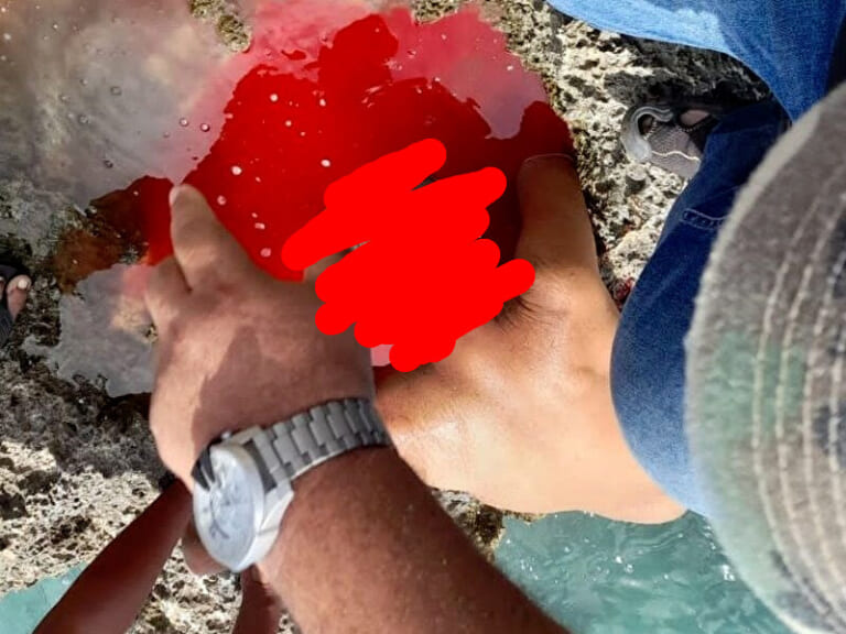 【閲覧注意】南米の海で ”モンスター” に襲われ死亡した観光客の画像が流出。これはアカン…