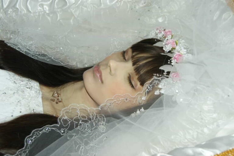 【閲覧注意】18歳なのに末期癌で死亡したロシア美女の遺体、美しすぎると話題に
