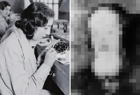 【閲覧注意】100年前、ラジウムを塗料に使っていた女性労働者はこうなっていた…（画像あり）