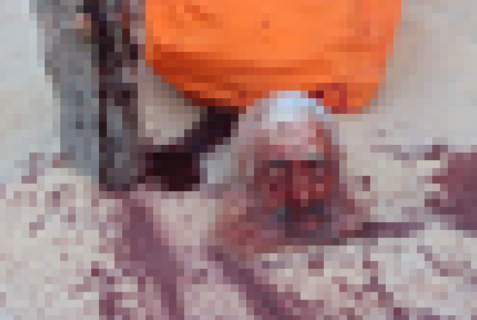 【超！閲覧注意】人間さん、”この状態” で動いてしまう・・・