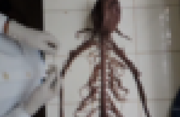 【閲覧注意】本物の人体実験、あまりにもヤバすぎる・・・・・（動画あり）
