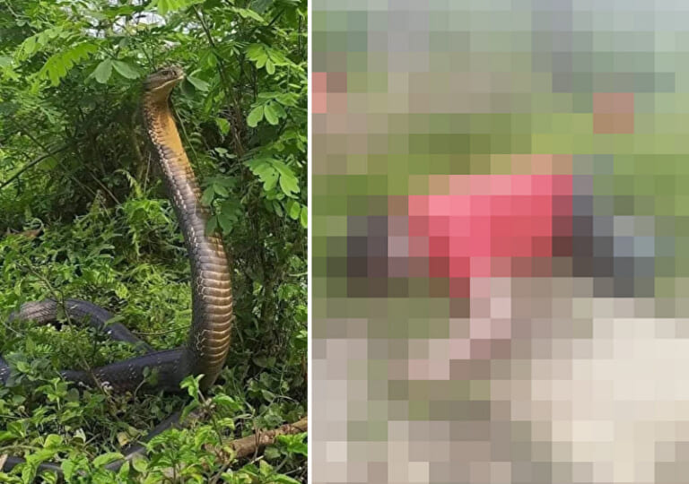 【閲覧注意】キングコブラに噛まれた人間はこうなって死ぬらしい・・・恐ろしい画像