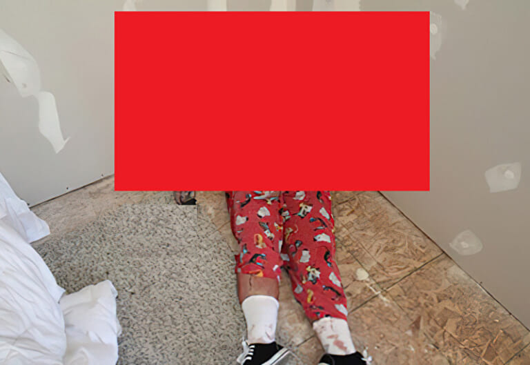 【閲覧注意】妻の遺体を献体に出した ⇒ その後の妻の写真を見て、私は気絶した（画像あり）