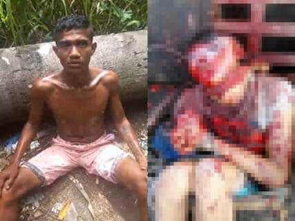 【閲覧注意】覚醒剤がどれだけヤバいかよく分かる動画