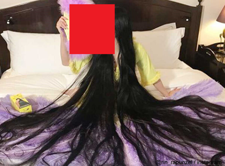 【閲覧注意】「ラプンツェル症候群」の女の子の動画がヤバイ。これ後1週間放っといたら死んでたらしい
