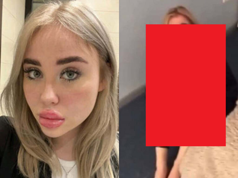 【閲覧注意】ウクライナ人女性のビフォーアフター、やばい・・・・・（動画あり）
