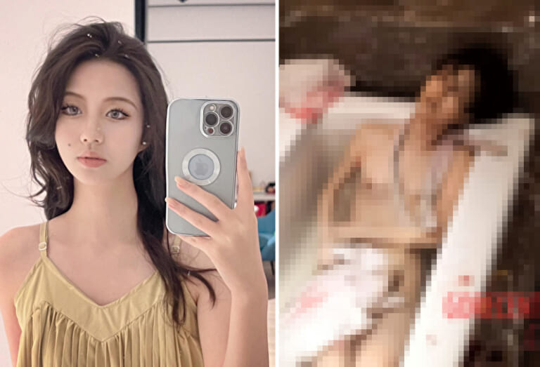 【閲覧注意】バリ島で襲われた美少女・観光客の全裸ビフォーアフター、ヤバすぎる（画像あり）
