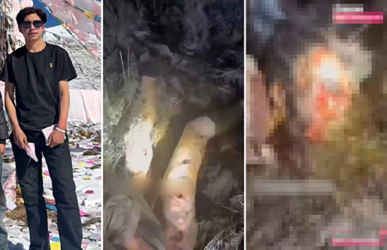 【超！閲覧注意】中国でヒグマに襲われたこのイケメンのビフォーアフター、ヤバすぎる（動画あり）