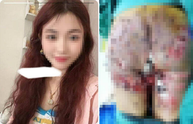 【閲覧注意】エイズなのにＨしまくってた女の「顔」と「セ○クス動画」が拡散される。美人すぎだろ…