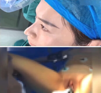 【本物】麻酔科医が全身麻酔中の美女をレ●プした動画、ヤバすぎる