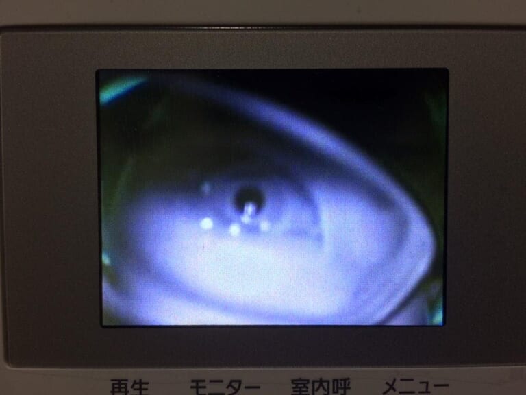【閲覧注意】女さん、自宅に来たストーカー男を晒すも「どんなホラー映画より怖い」と話題に（動画あり）