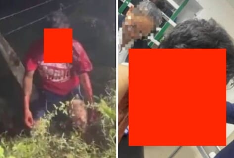 【閲覧注意】バイク事故で吹き飛ばされたライダー、無事生還できたけど顔面が…（動画あり）