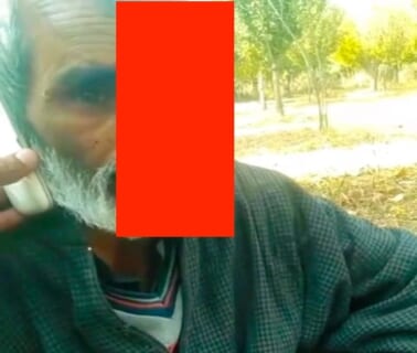 【閲覧注意】熊に殴られたおじさん、たった一発でこうなる（動画あり）