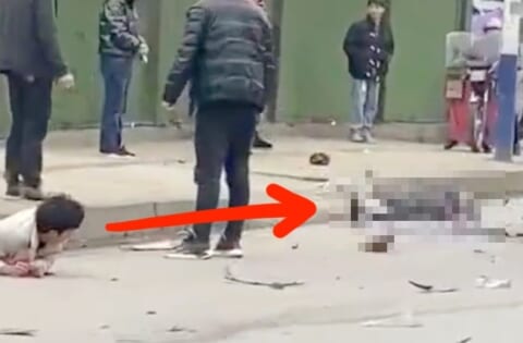 【閲覧注意】事故で真っ二つなのにピンピンしてる男、自分の下半身と「対面」して絶望…（動画あり）