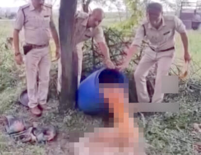 【閲覧注意】インドのニュース番組、酸で溶けた「人体」をモザイクなしで流してしまう…（動画あり）