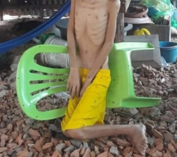 【閲覧注意】自分の顔に絶望し自殺した高校生の ”顔” をご覧ください…これはヤバい（画像あり）