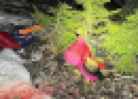 【閲覧注意】この前クマに襲われた女性の画像・・・ヤバすぎだろ・・・（画像あり）