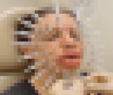 【閲覧注意】美容整形を重ねた女の末路、ヘルレイザーみたいになってしまう（動画あり）