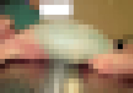 【閲覧注意】小学生「最近ウンコ出ないけどまあいいや」⇒ ガチでヤバい事になる（画像あり）