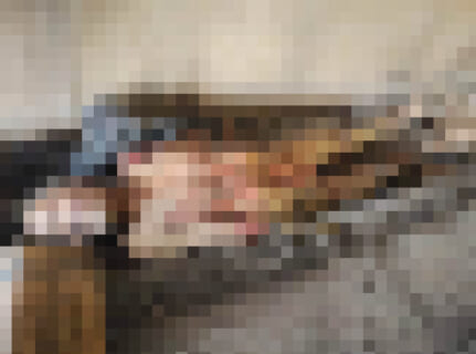 【閲覧注意】海外の違法臓器売買組織、街のホームレスを ”在庫” にしていた…（画像あり）