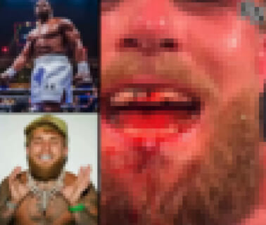 【閲覧注意】有名YouTuberがボクシング世界ヘビー級王者に顎を粉砕される動画、ヤバすぎる