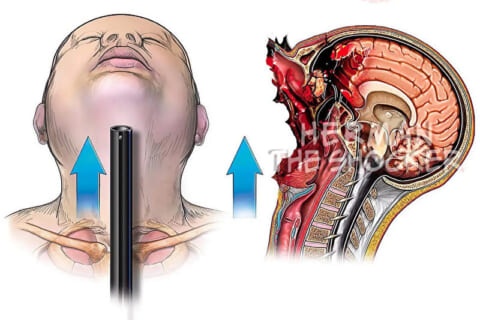 【超！閲覧注意】見てはいけない画像