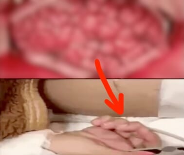 【閲覧注意】医師「脳のココを触ったら体がピクピク動くんです」⇒ 公開してはいけない動画