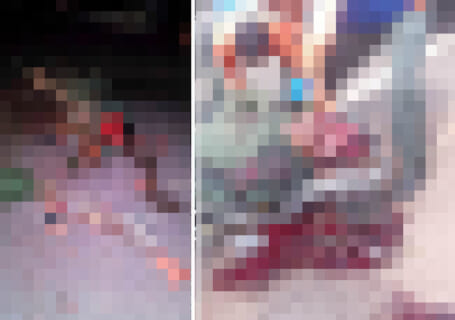 【閲覧注意】米軍に攻撃されたベネズエラ、流出した無修正画像・動画が地獄絵図すぎる