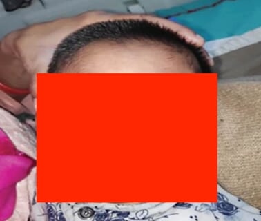 【閲覧注意】3歳の男の子、好奇心で「噛んだらいけないもの」を噛んだ結果…（画像あり）