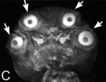 【閲覧注意】このレントゲン写真の人間（目が4つある）の実際の姿、あまりにもヤバすぎる