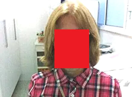 【閲覧注意】ブラジルで行方不明になった人妻。顔の皮を剥がされ両目をえぐり出された状態で発見される