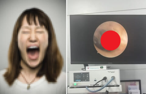 【閲覧注意】タイ旅行中の女性「耳の中に何かいるの！誰か助けて！」→ 耳の中見たら…（動画あり）