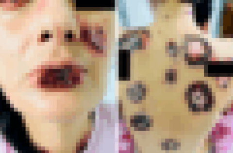 【閲覧注意】３人の男の子とセ○クスしまくった ⇒ 数か月後、私の身体が・・・（画像あり）