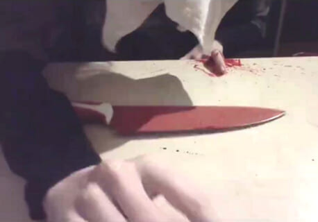 【閲覧注意】メンヘラ女子、五体不満足になった瞬間 精神崩壊してしまう…（動画あり）